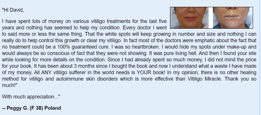 vitiligo miracle review